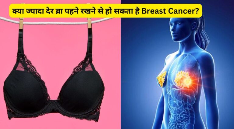 Breast Cancer